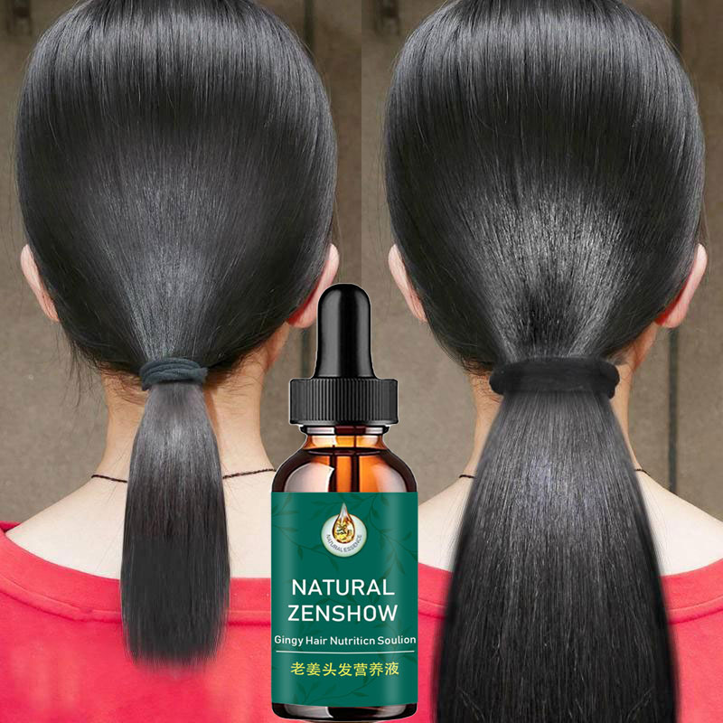 Hair Care Herbal Products - زيت عطري لنمو الشعر بالزنجبيل ،