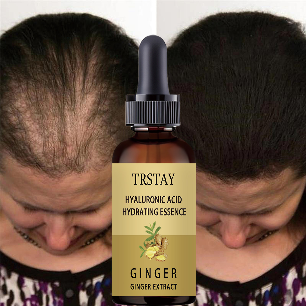 Hair Care Gisou - سيروم نمو الشعر المضاد لمنع تساقط