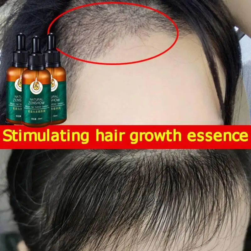 زيت عطري لنمو الشعر بالزنجبيل  - مراجعة Hair Care Herbal Products وسعره