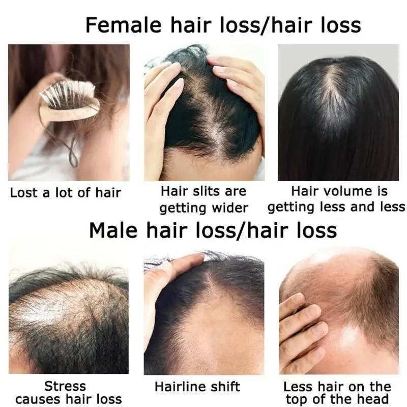 زيت عطري لنمو الشعر بالزنجبيل  - مراجعة Hair Care Herbal Products وسعره