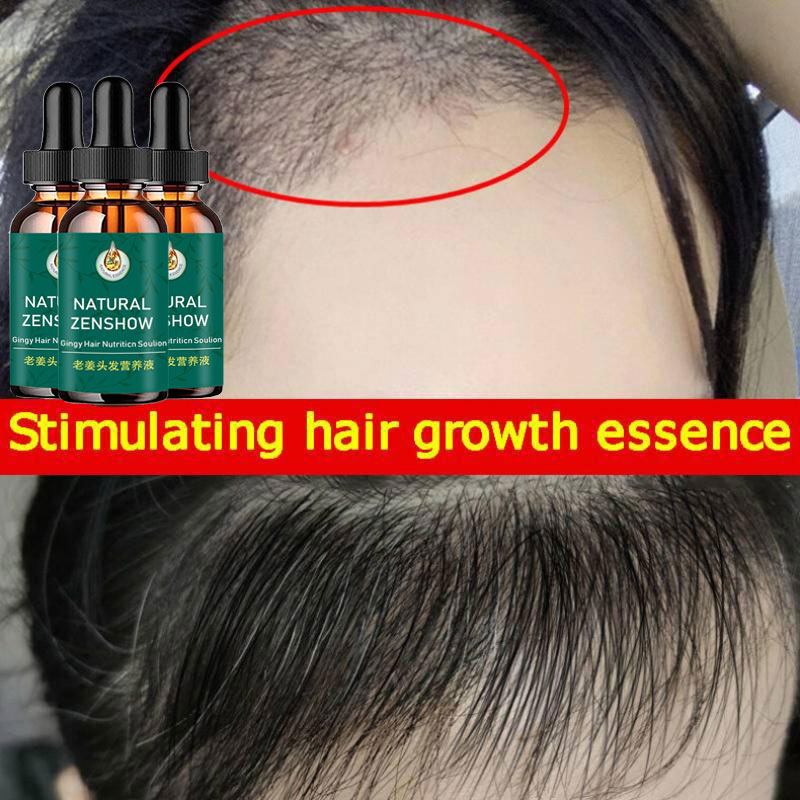 زيت عطري لنمو الشعر بالزنجبيل  - مراجعة Hair Care Herbal Products وسعره