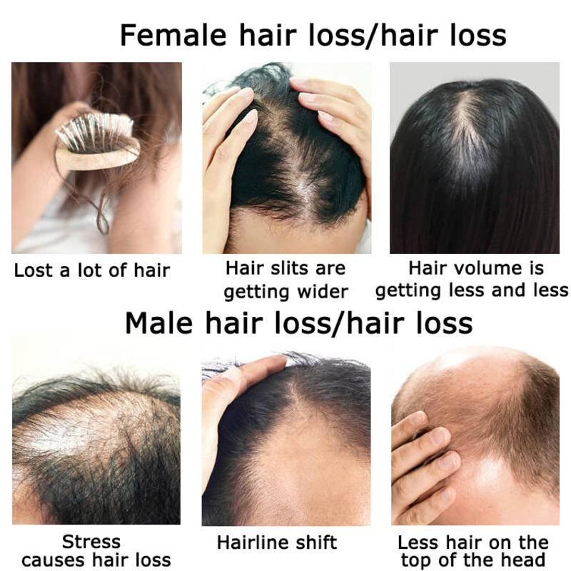 زيت عطري لنمو الشعر بالزنجبيل  - مراجعة Hair Care Herbal Products وسعره