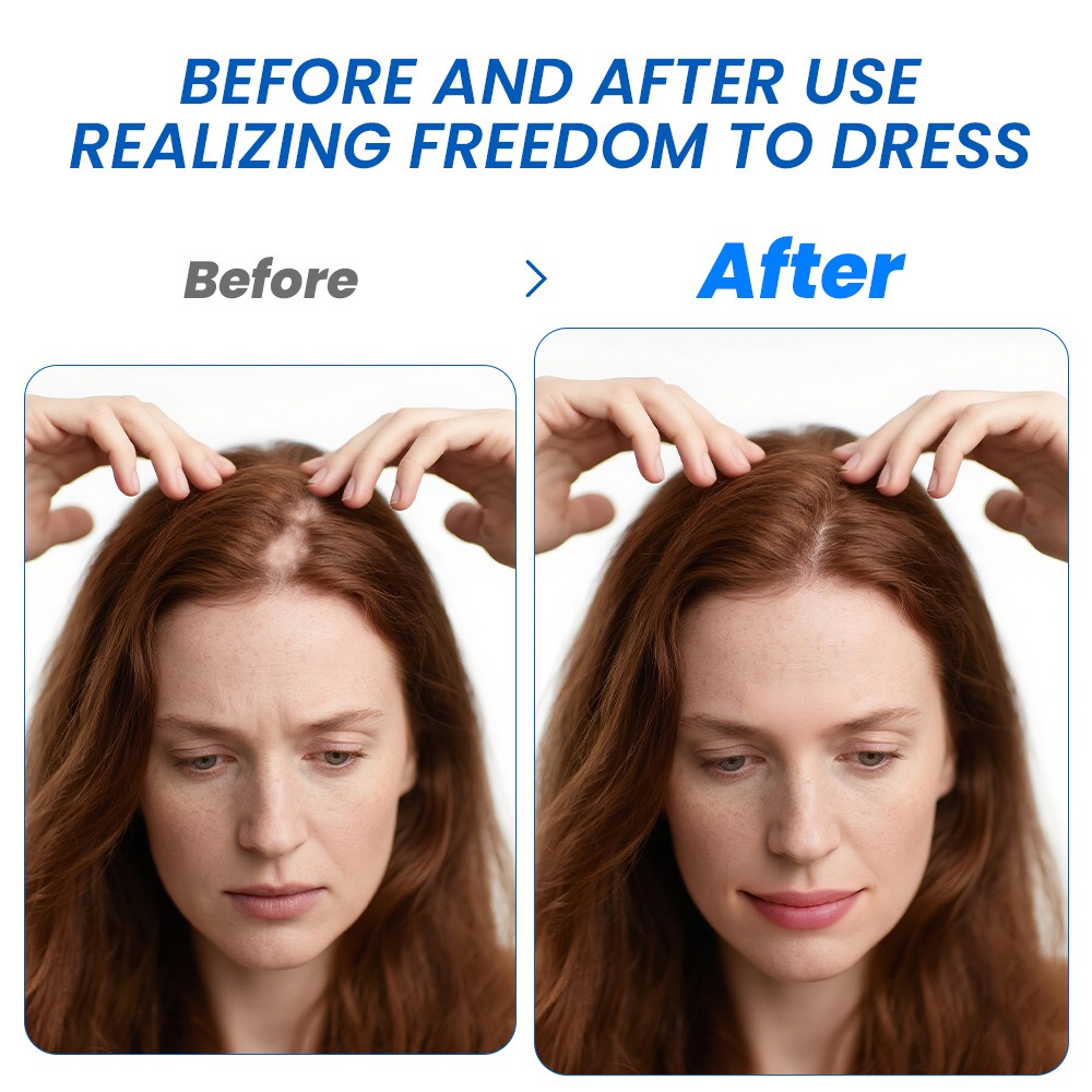 الثعلبة نمو الشعر رذاذ Sophora - مراجعة Hair Care Growth وسعره