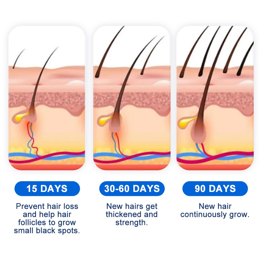 الثعلبة نمو الشعر رذاذ Sophora - مراجعة Hair Care Growth وسعره