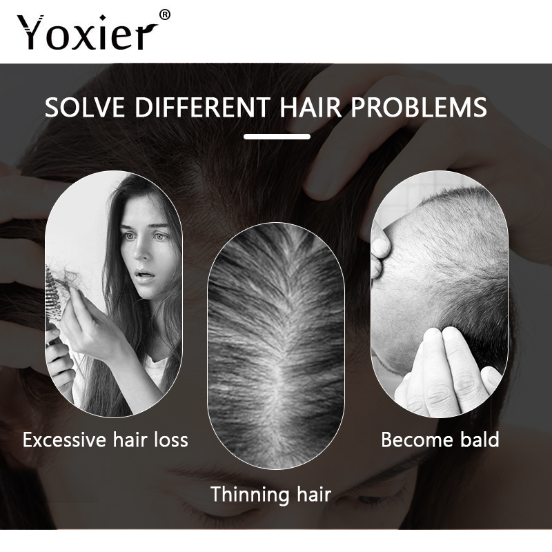 سيروم نمو مكثف يمنع تساقط الشع - مراجعة Hair Care Growth وسعره