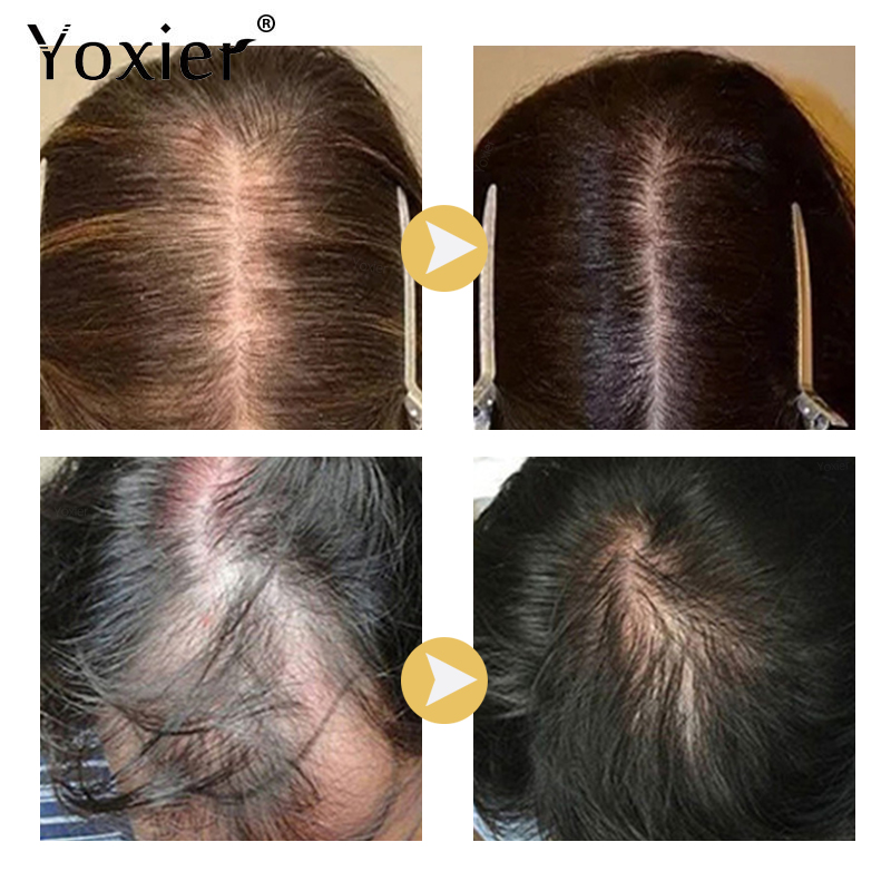 سيروم نمو مكثف يمنع تساقط الشع - مراجعة Hair Care Growth وسعره