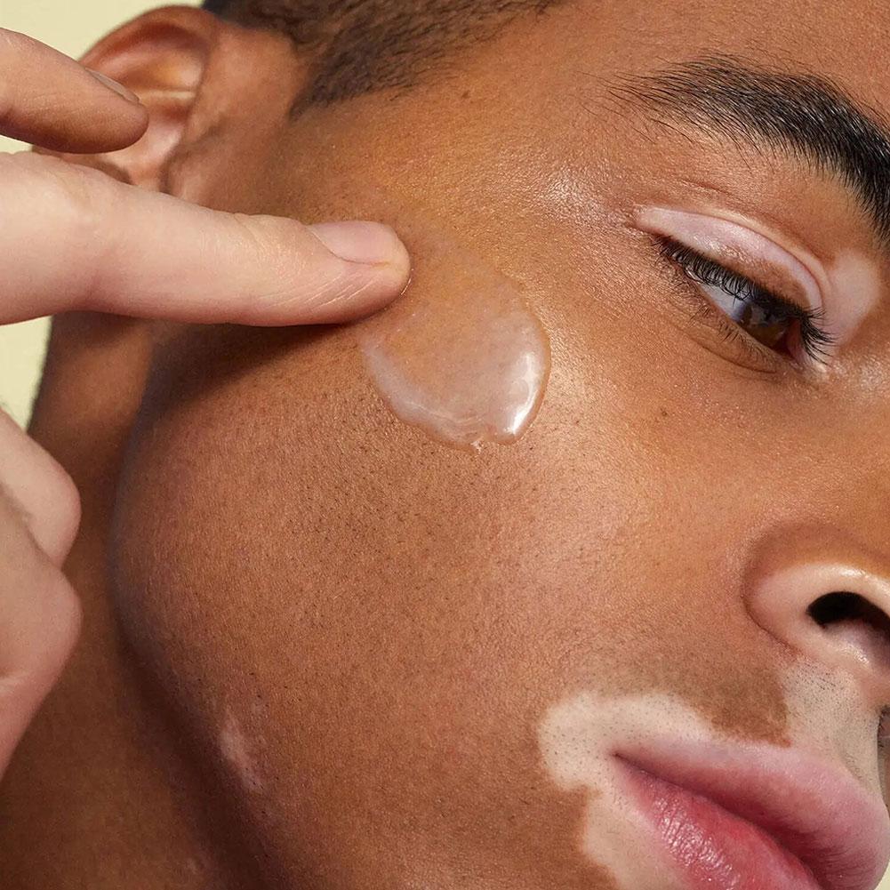 كريم جل النيكوتيناميد الثلاثي  - مراجعة Hair Care Gisou وسعره