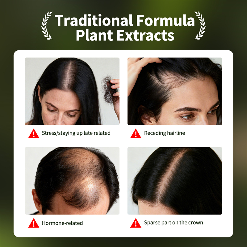 مجموعة نمو الشعر الطبيعي صابون - مراجعة Hair Care Herbal Products وسعره