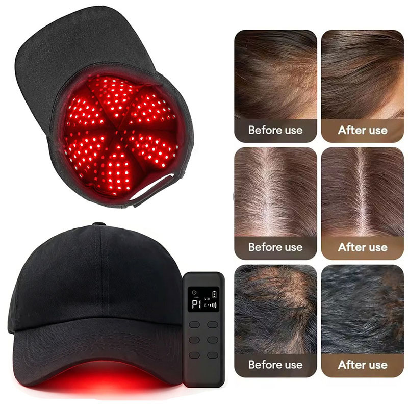 قبعة العلاج بالضوء الأحمر بتقن - مراجعة Hair Care Wella وسعره
