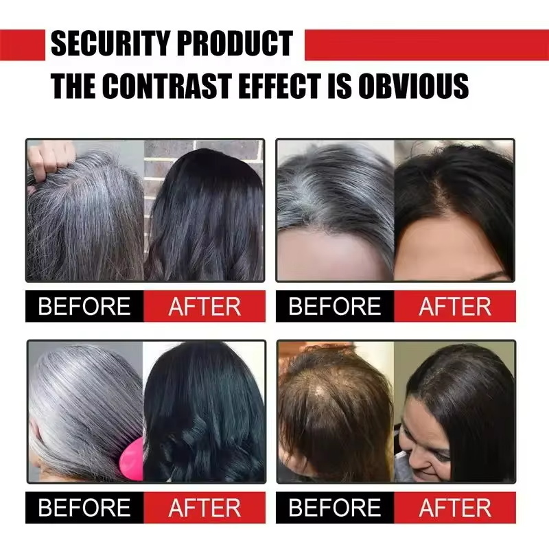 كريم سيروم عشبي لعلاج الشعر ال - مراجعة Hair Care Herbal Products وسعره