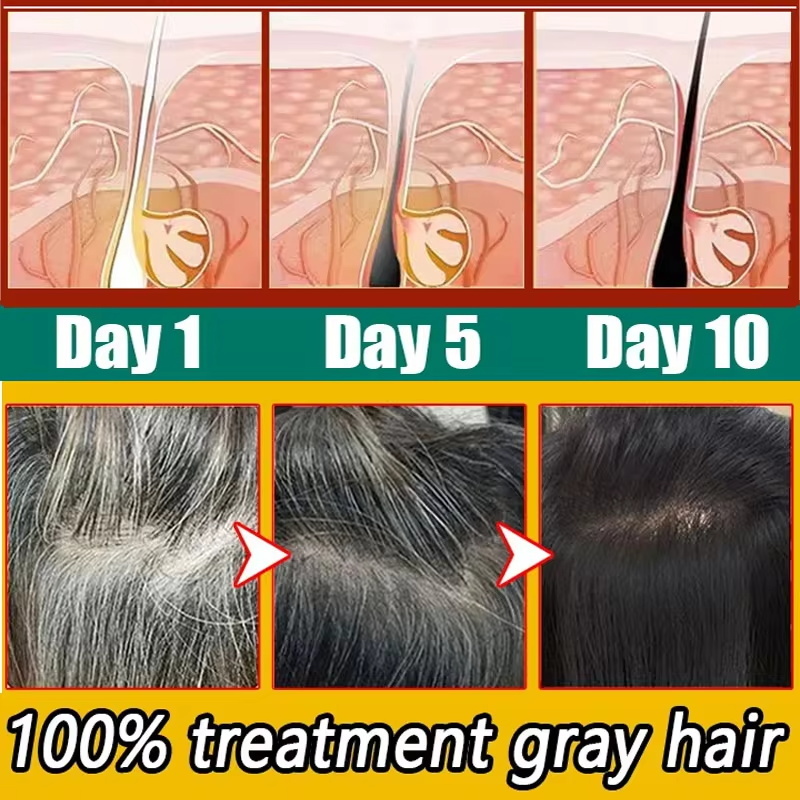 كريم سيروم عشبي لعلاج الشعر ال - مراجعة Hair Care Herbal Products وسعره