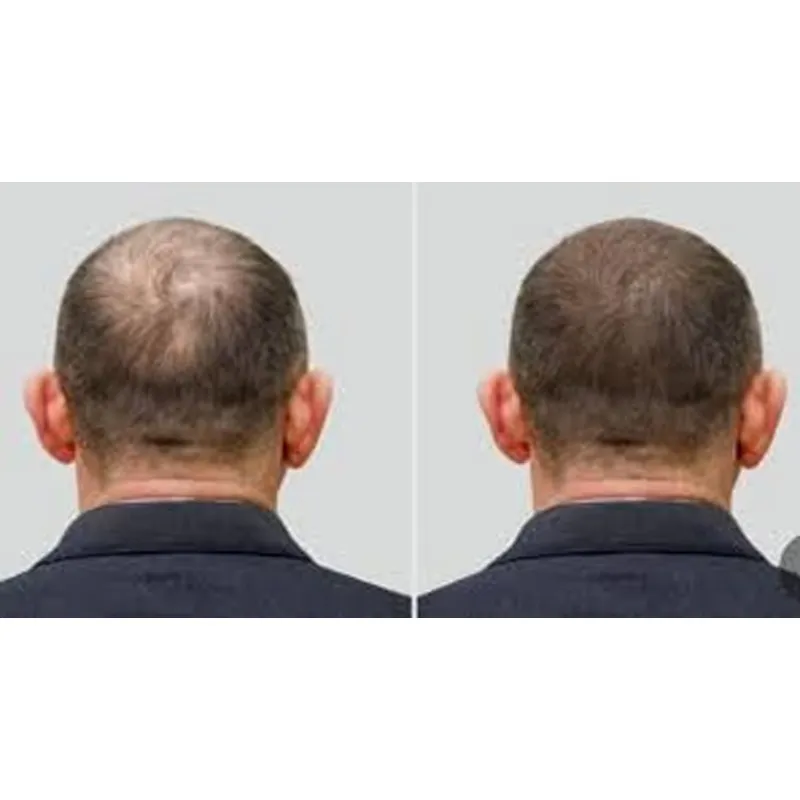 قبعة الأوزون ذات الإغلاق المحك - مراجعة Hair Care Good Hair وسعره
