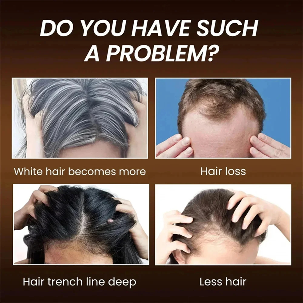 كريم سيروم عشبي لعلاج الشعر ال - مراجعة Hair Care Herbal Products وسعره