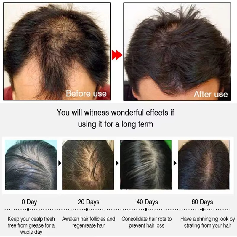 بخاخ الزنجبيل السريع لنمو الشع - مراجعة Hair Care Growth وسعره