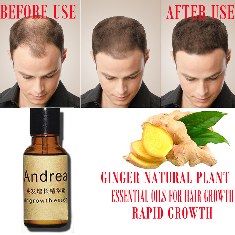 2/5/10 قطعة أندريا زيت مصل نمو - مراجعة Hair Care Herbal Products وسعره