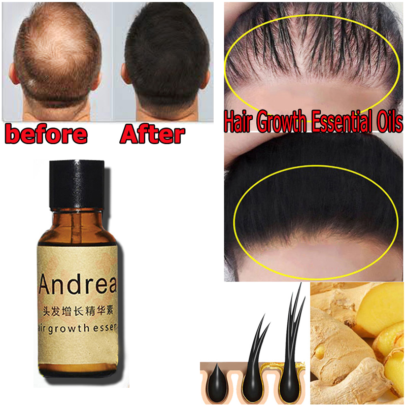 2/5/10 قطعة أندريا زيت مصل نمو - مراجعة Hair Care Herbal Products وسعره