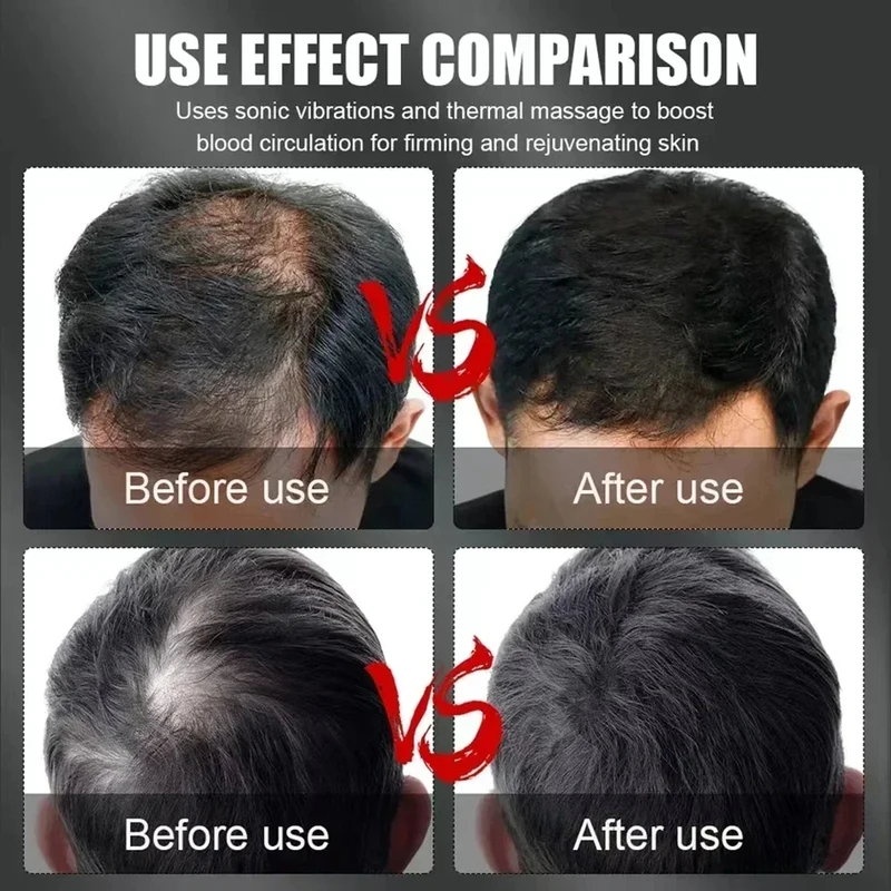 قبعة علاج الشعر بالضوء الأحمر  - مراجعة Hair Care Growth وسعره